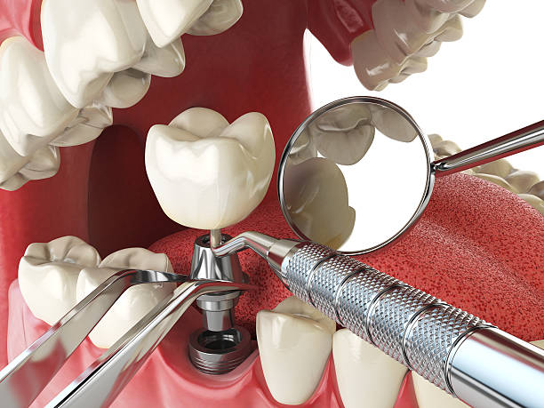 Best Orthodontic Emergency Dentist in Rose Hills, CA